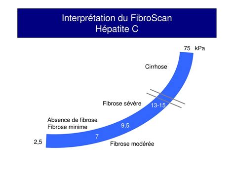 fibroscan interpretation|fibroscan lecture du résultat.
